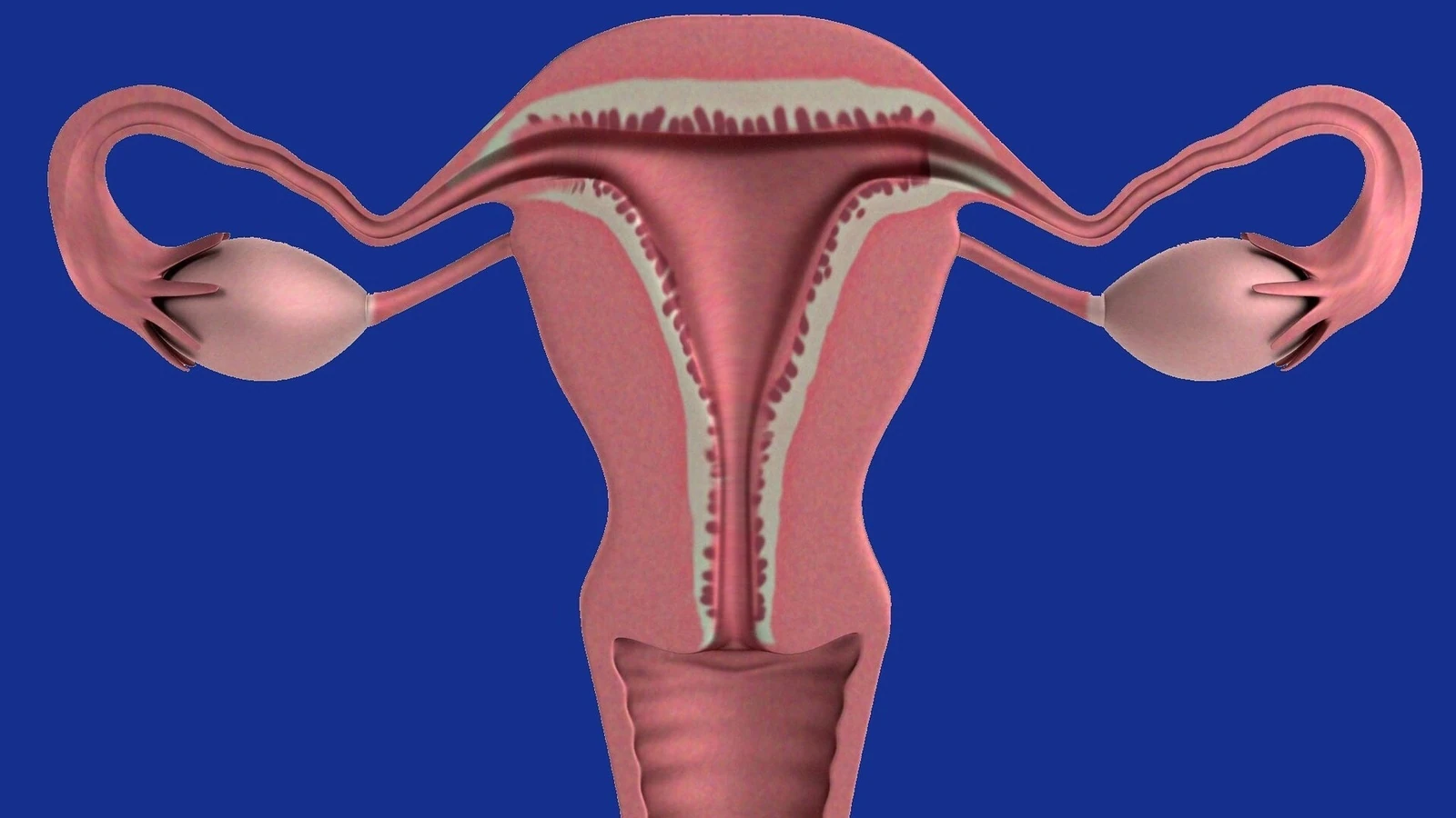 Ovarian cancer: Women should watch out for these warning signs