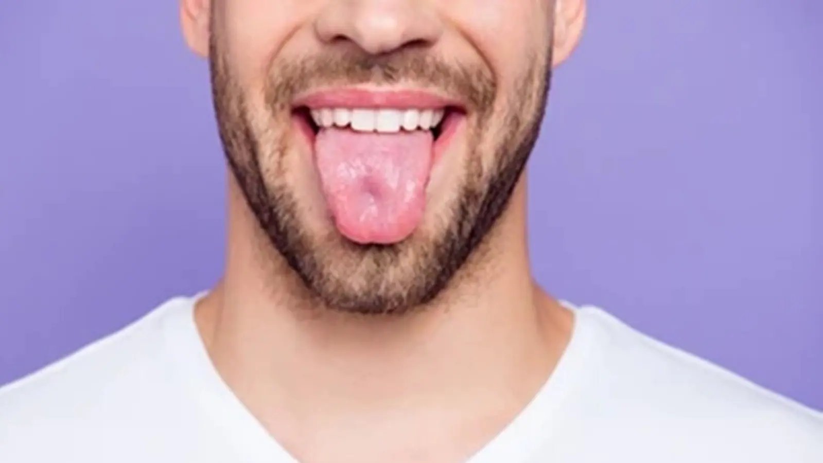 Stroke survivor develops ‘black hairy tongue’; know all about this condition from experts