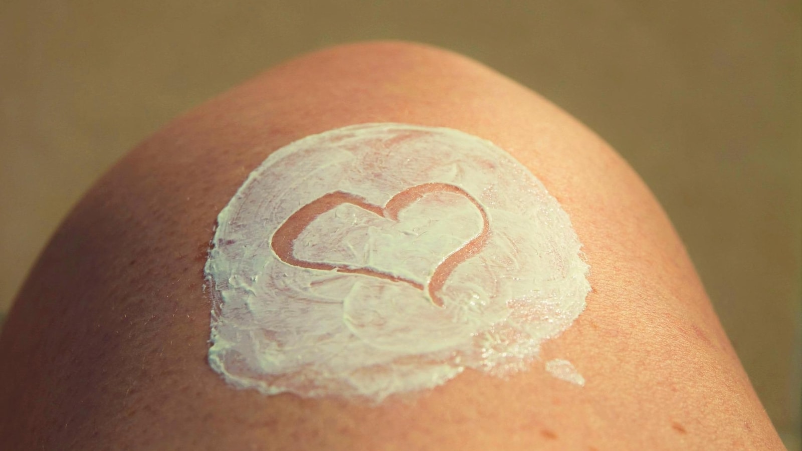 Expert tips on how to treat and manage burn scars and sun burn