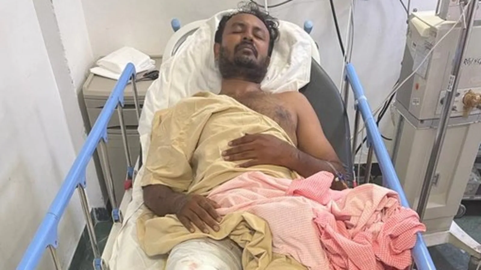 Bengaluru acid attack accused tried to escape, was shot in the leg by police