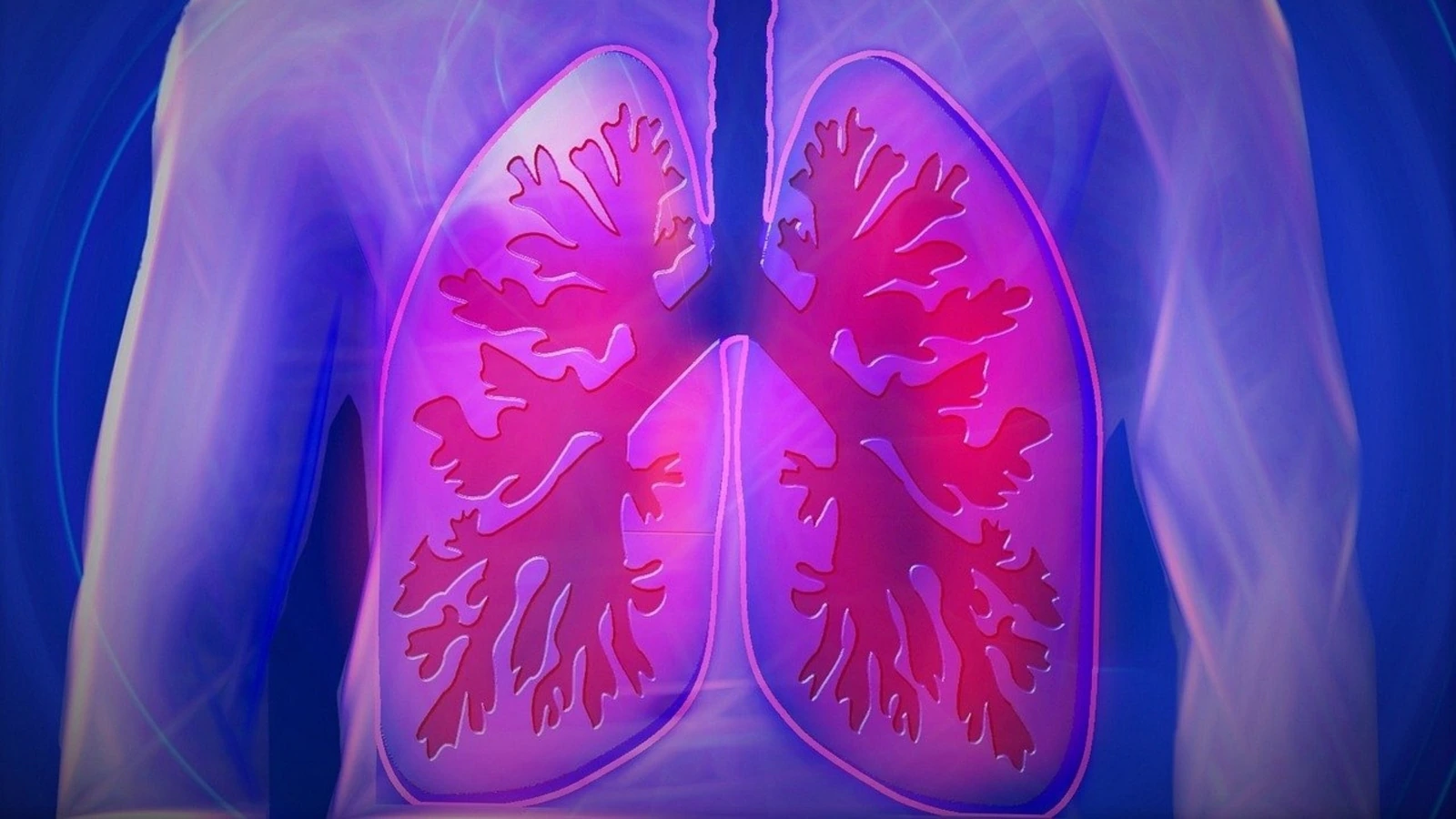 Air pollution: Management tips for people suffering from lung or other forms of health problems